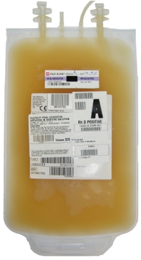 A unit of platelets A unit of platelets